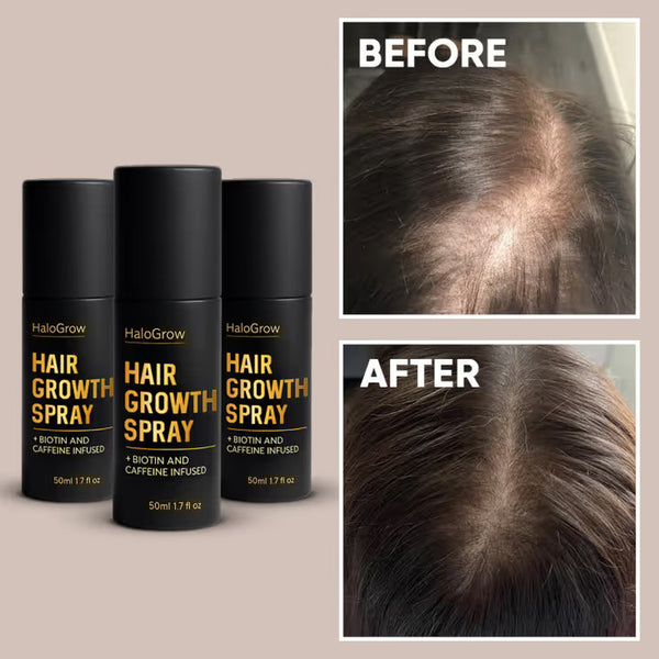 Hairspray for Scalp & Hair Care – HaloGrow Nourishing Formula 